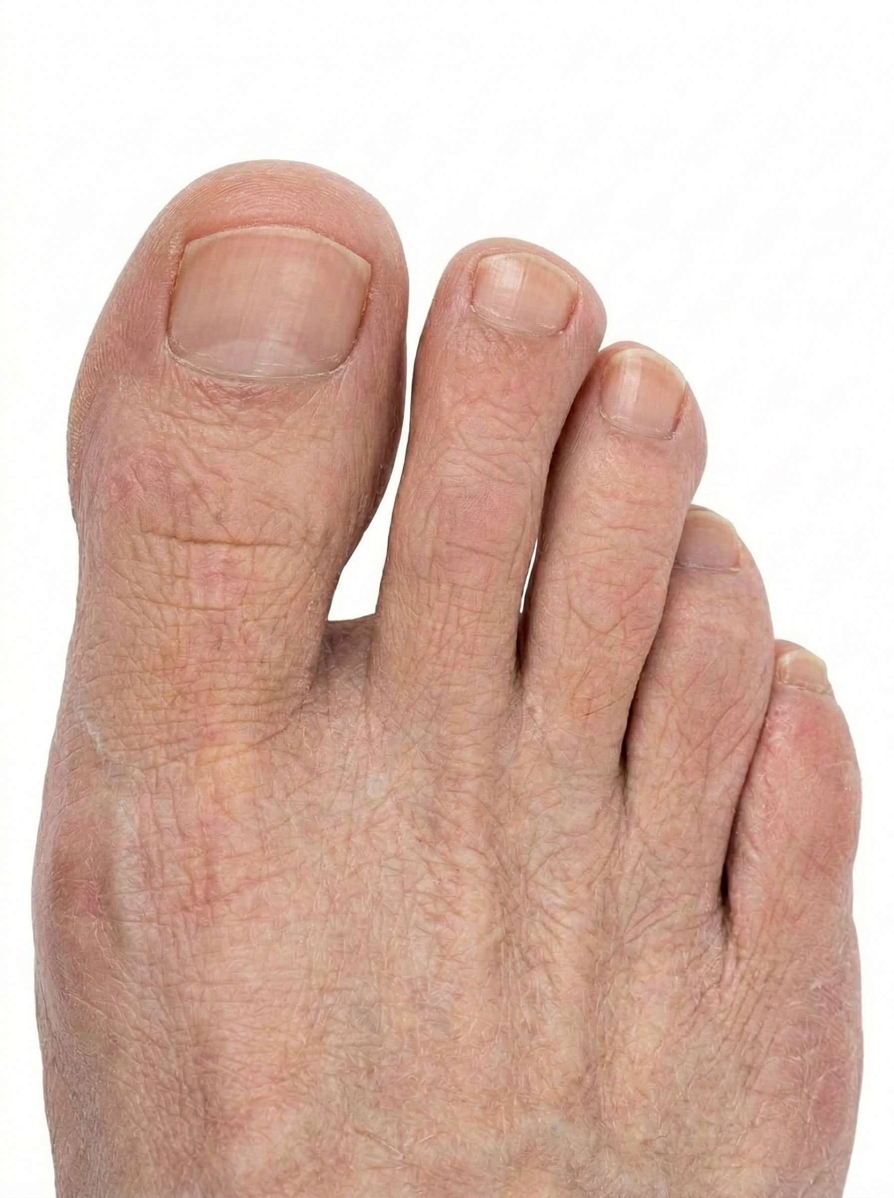 Objetivo após tratamento